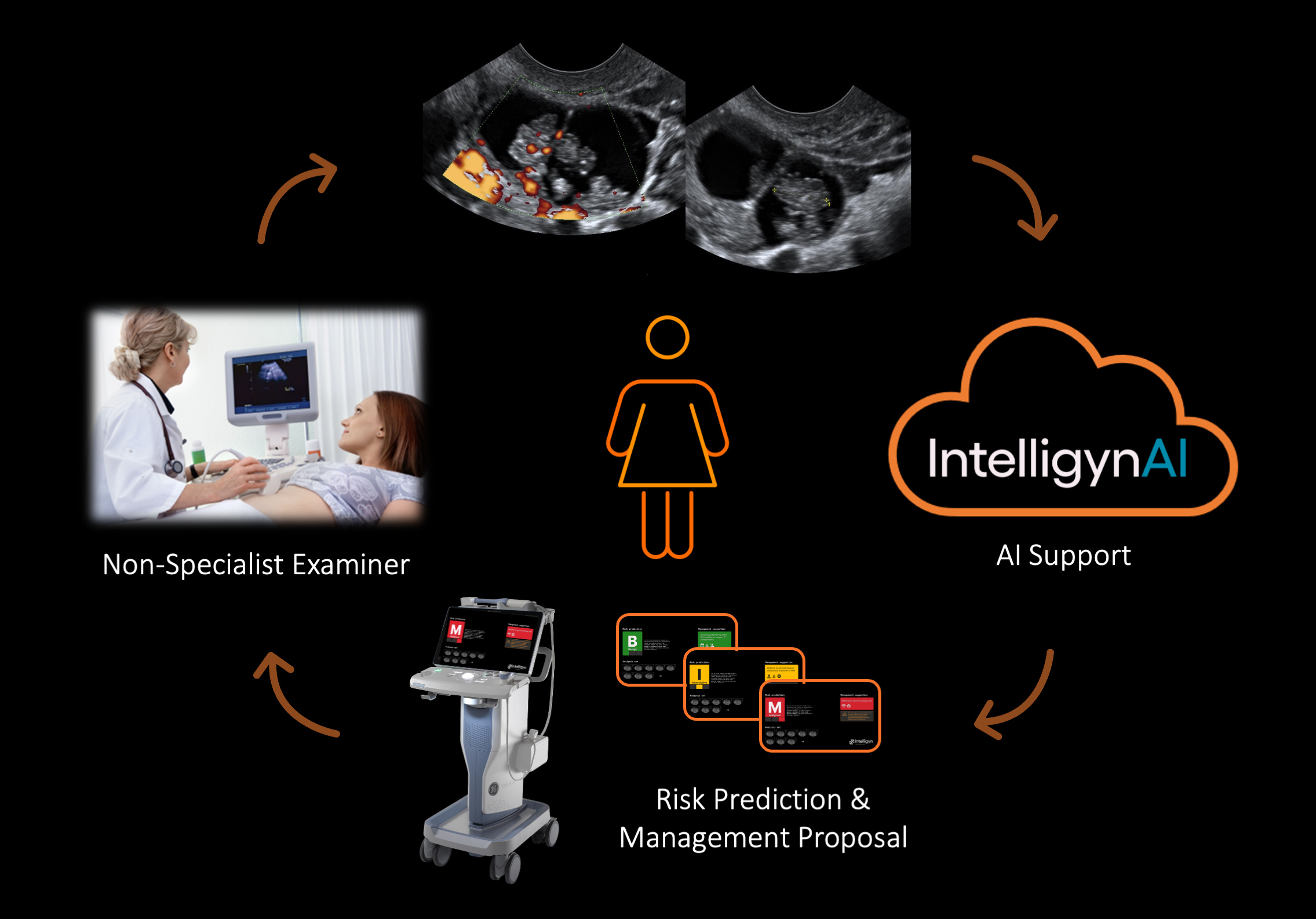 Illustration of the workflow for AI-driven diagnostic support in ovarian tumor assessment. The process begins with a non-specialist performing an ultrasound, capturing images which are sent to the IntelligynAI platform for analysis. The platform provides a cancer risk prediction and management proposal, visualized on the ultrasound system.