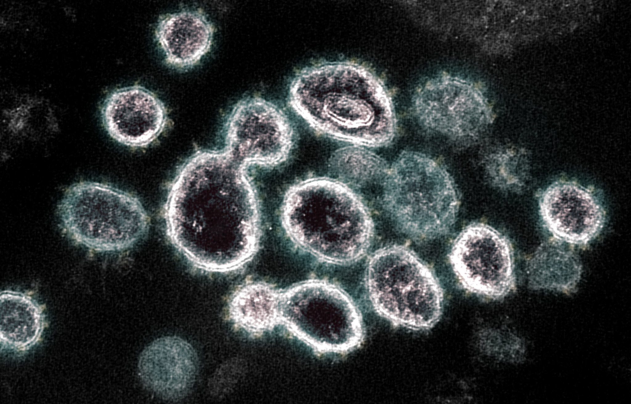 A transmission electron microscope image of SARS-CoV-2, the virus that leads to COVID-19. Credit: Credit: NIAID-RML