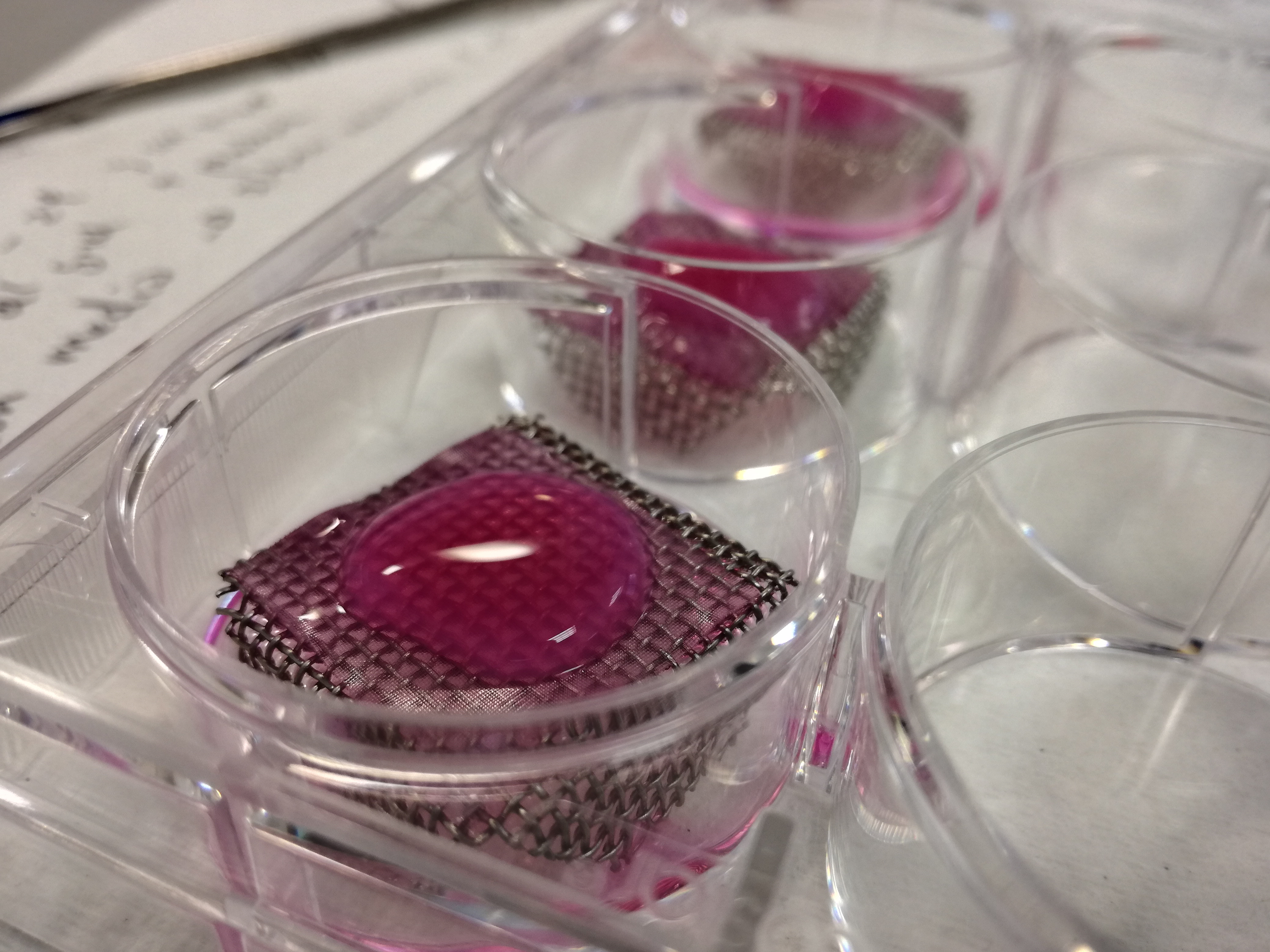 Organotypic 3D culture (left) and mice injected with breast cancer cells (right)