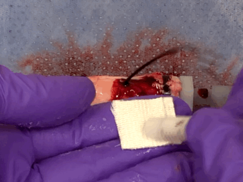 Rapid and coagulation-independent hemostasis by the paste