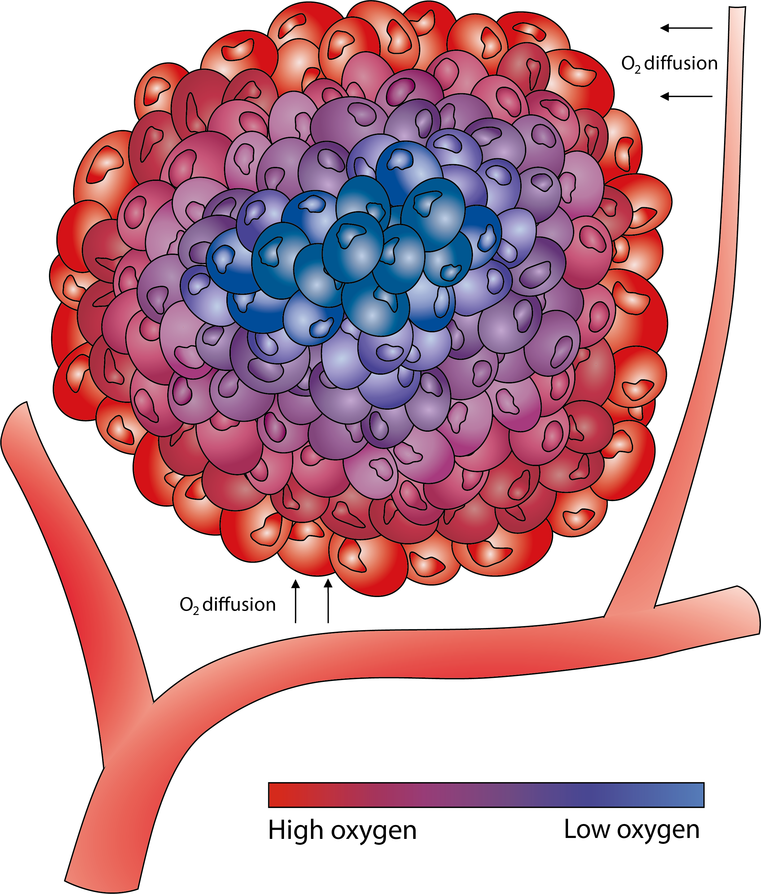 Tumour hypoxia