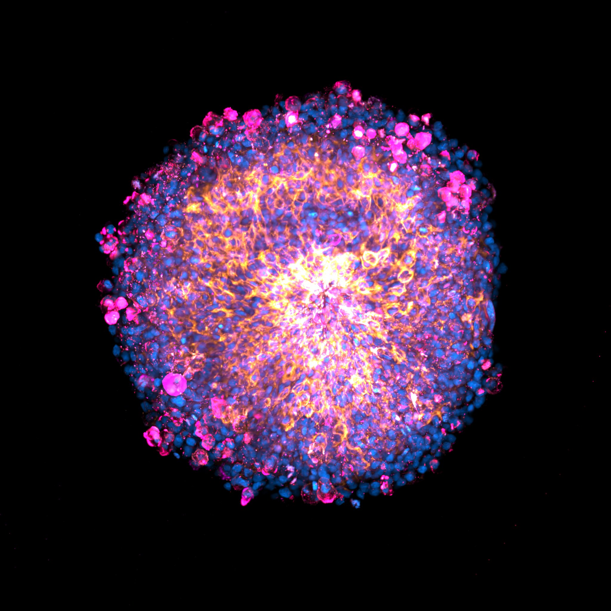 Fluorescence microscope image of a placental organoid. The nucleus of each cell looks like a blue dot with different cells showing in pink, purple and orange.