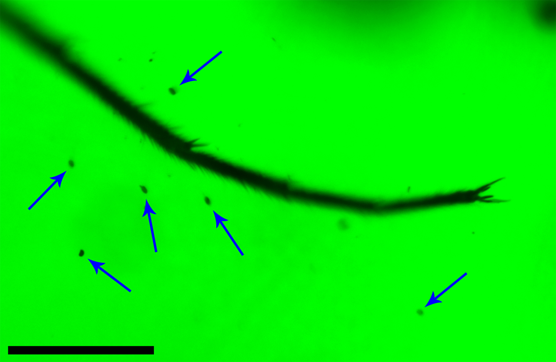 Fig. 2 The tarsus of Parapolycentropus paraburmiticus surrounded by pollen grains, CNU-MEC-MA-2017012, under green epifluorescence. Fig. 2 The tarsus of Parapolycentropus paraburmiticus surrounded by pollen grains, CNU-MEC-MA-2017012, under green epifluorescence.
