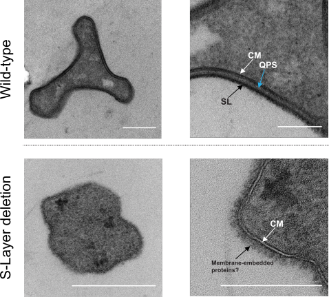 Electron microscopy Electron microscopy