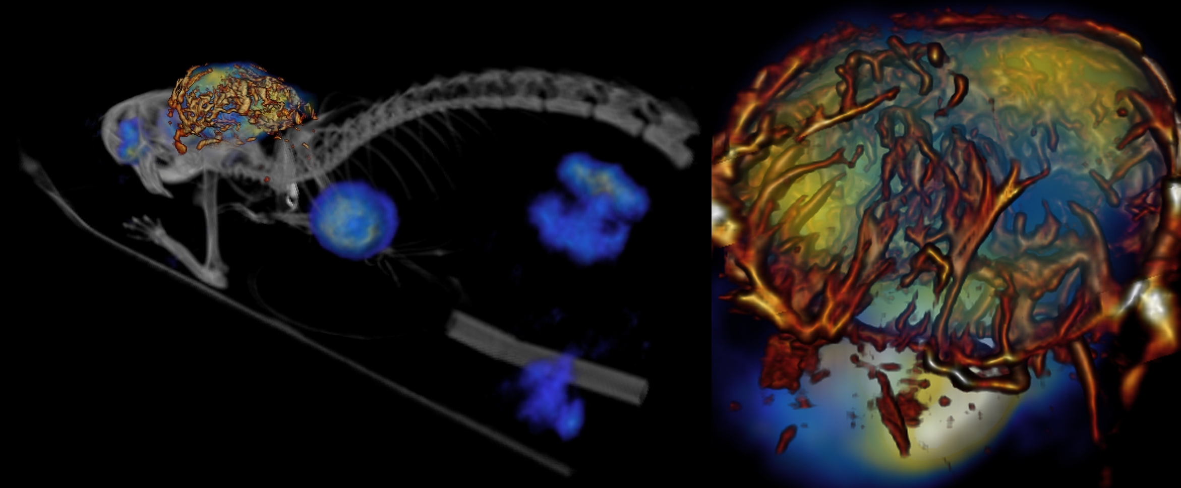 Imaging vasculature and metabolism in a tumour Imaging vasculature and metabolism in a tumour