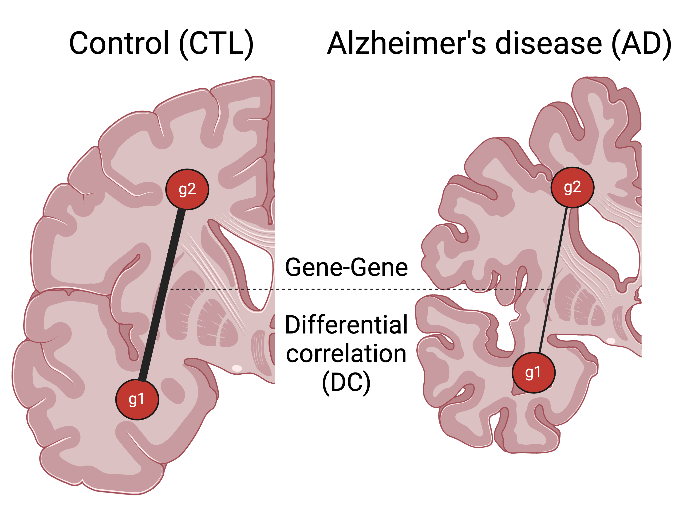 Fig 1. InterTissueDC framework. Represented here are two identical slices of the human brain. One slice is from a control case, and the other slice is from an AD-affected case marked by brain shrinkage due to neurodegeneration. g1-g2 represents a gene pair across two different brain regions. The edge thickness between g1 and g2 represents the correlation strength between the gene expression of g1, and g2. The differential correlation (DC) between genes in two tissues, referred to as InterTissueDC, tests for the change in correlation strength between the diseased state and the control state. DC gene pairs are the g1-g2 pairs whose correlation is significantly gained or lost in the disease group compared to the controls. Image created with Biorender.com.