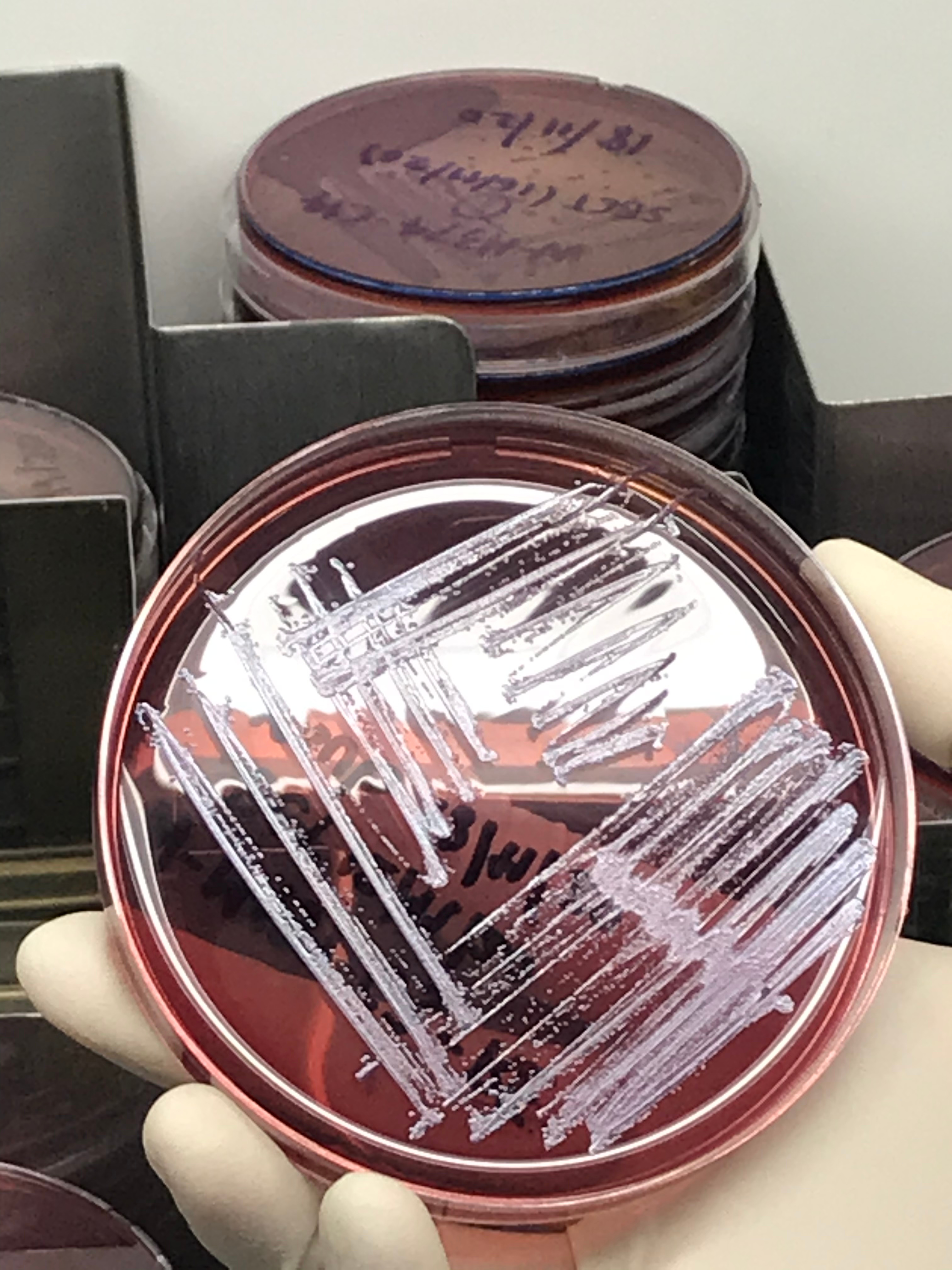 Burkolderia pseudomallei appearing metallic sheen on the selective Ashdown agar