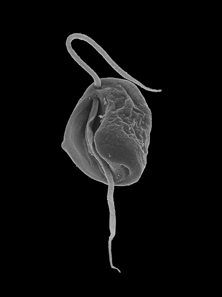 Scanning electron micrograph of Aduncisulcus paluster. Image courtesy of Dr. Naoji Yubuki, with permission