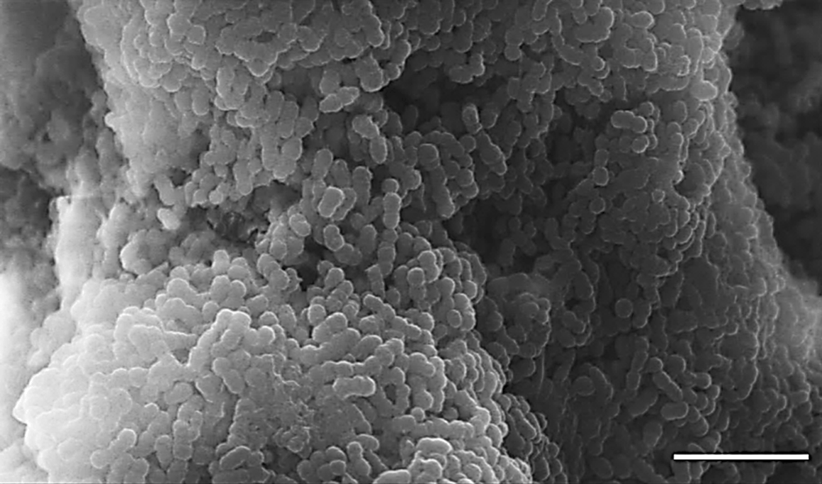 Figure 1. Scanning Electron Micrograph image of a S. mutans biofilm, with channels and void in biofilm microarchitecture. Scale bar = 5 µm