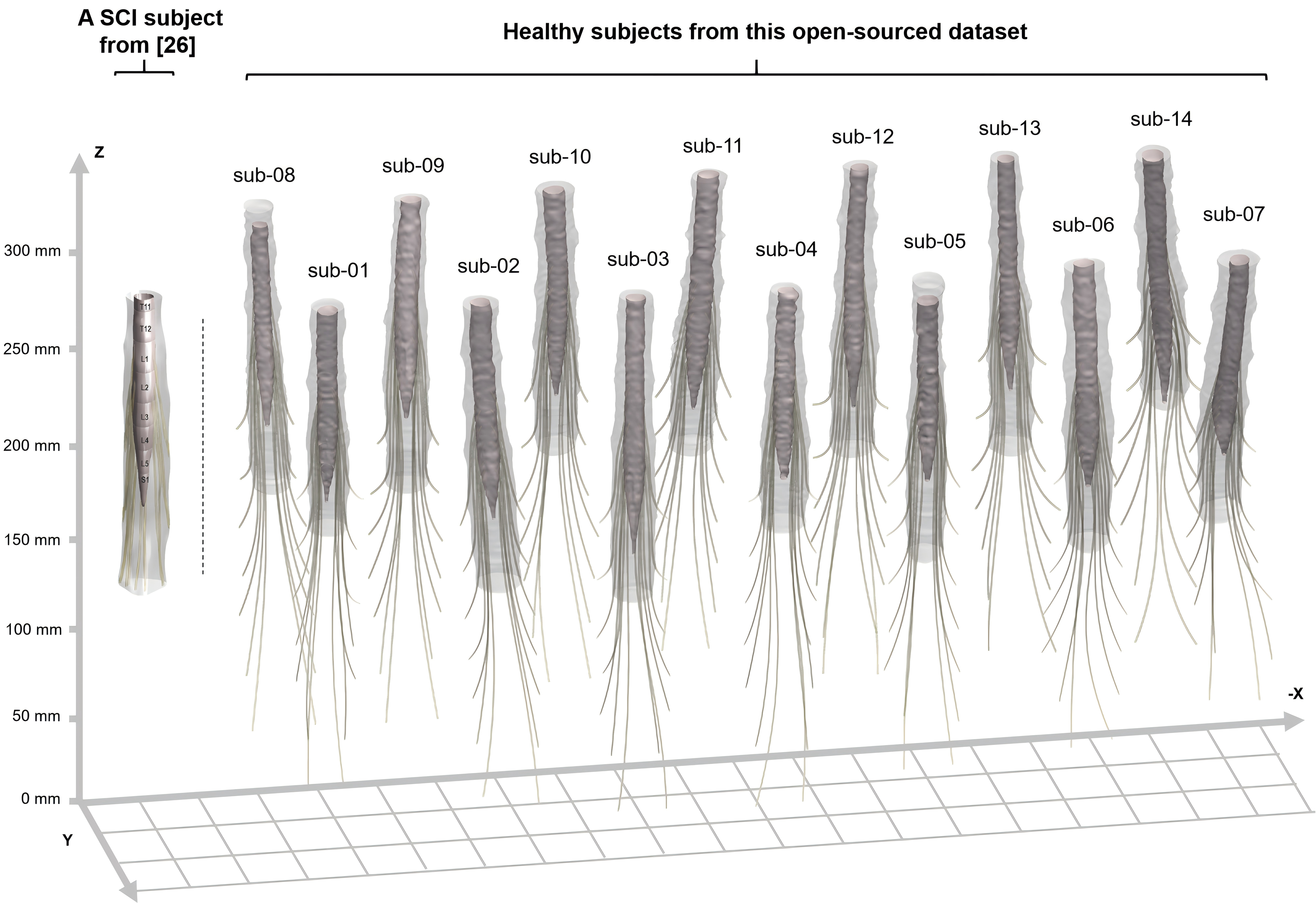 Visualization of human lumbosacral models based on MRI data. The right 14 models were from 14 healthy adult participants in this work. Comparatively, the left model was from a spinal cord injury subject in another research\cite{mesbah2023neuroanatomical} without open-sourced MR images, markers and models. Each model incorporates anatomical structures including the dura, cerebrospinal fluid, and nerve roots extending from L1 to S2. The direction of the coordinate axes is indicated. Spinal cord models were aligned by the highest planes of the dura structure to exhibit individual variability.