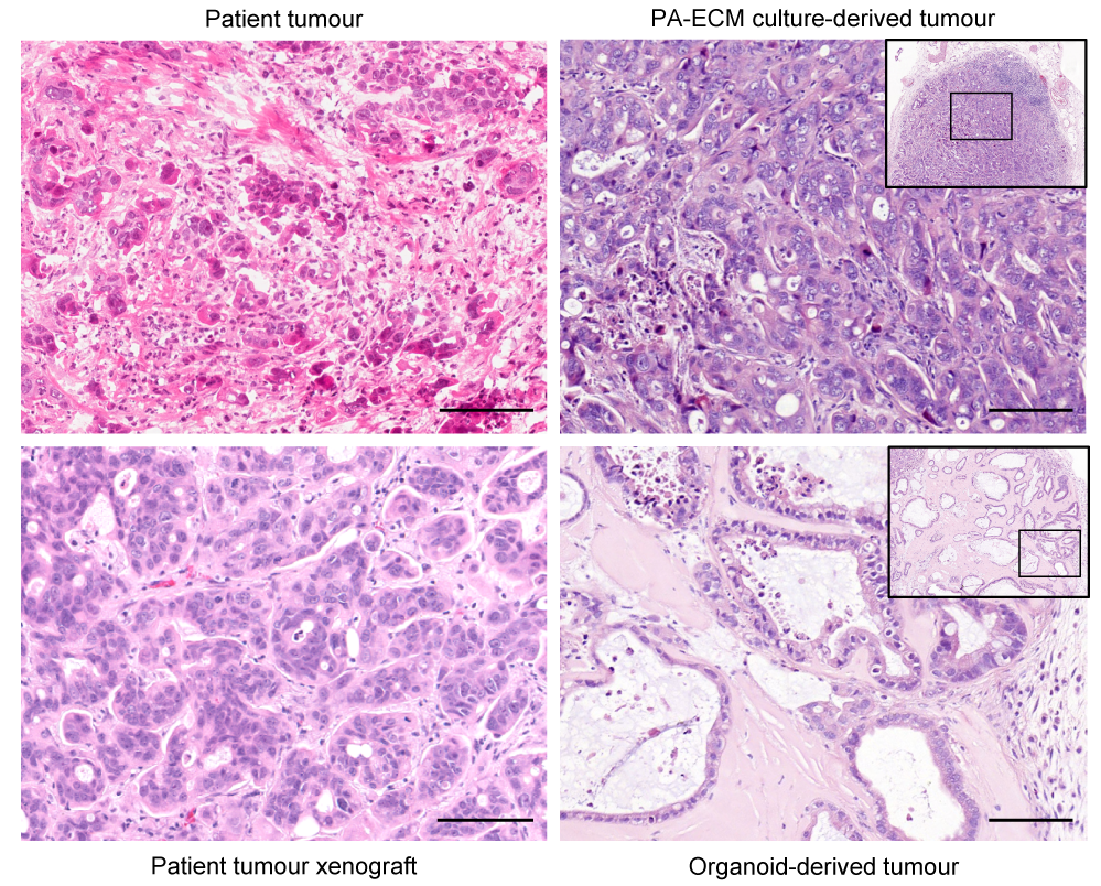 Tumours from self-assembled cultures and organoids differ in growth and histology.