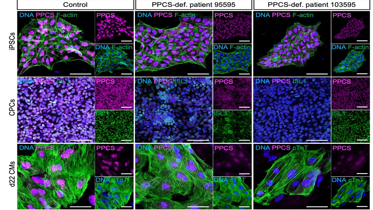 IF staining of PPCS together with F-actin, ISL1, or cTnT in control  and PPCS deficient iPSCs (patients 95595 and 103596) and derived CPCs, d22 CMs, and d60  CMs. Scale bars = 50 µm. Images are representative of n = 2 independent differentiations. (