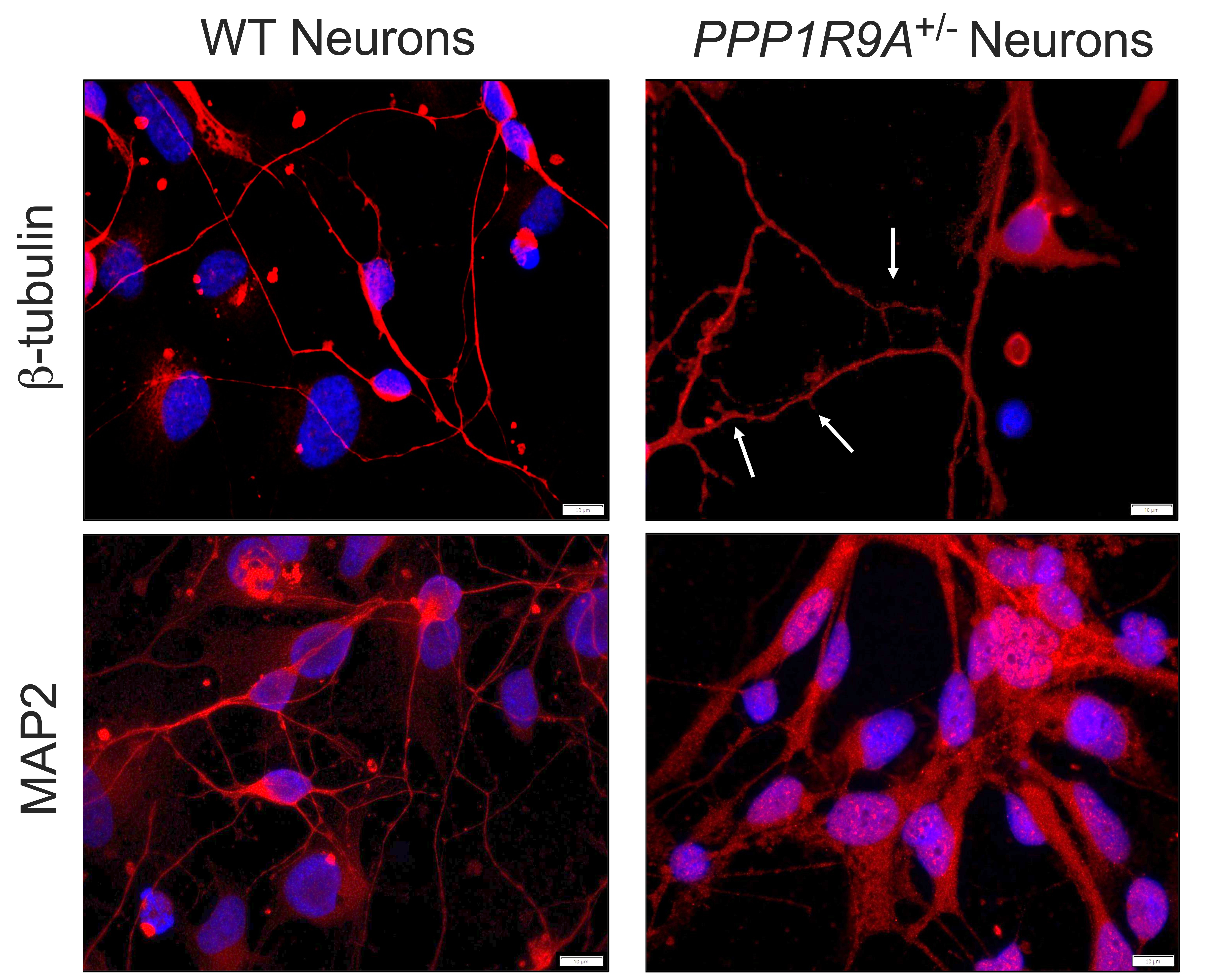The mutant neurons looked normal, even more elaborate than expected.