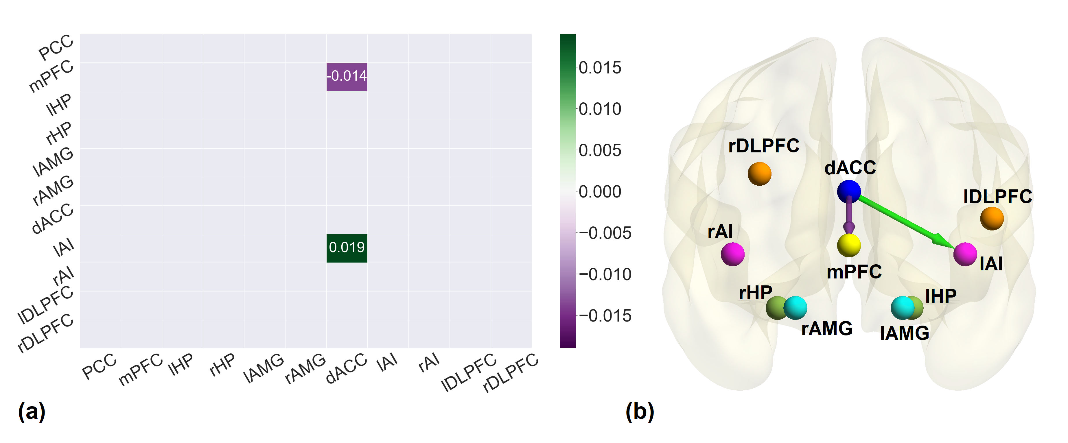a The association matrix between post-rTMS connectivity of active group and emotional health scores. The purple gradient indicates negative association while green gradient shows positive association. b The brain diagram of the association between post-rTMS effective connectivity of active group and emotional health. Green and Purple arrows illustrate the positive and negative association respectively. All the associations reported here survived the threshold of posterior probability >0.95 amounting to a strong evidence.