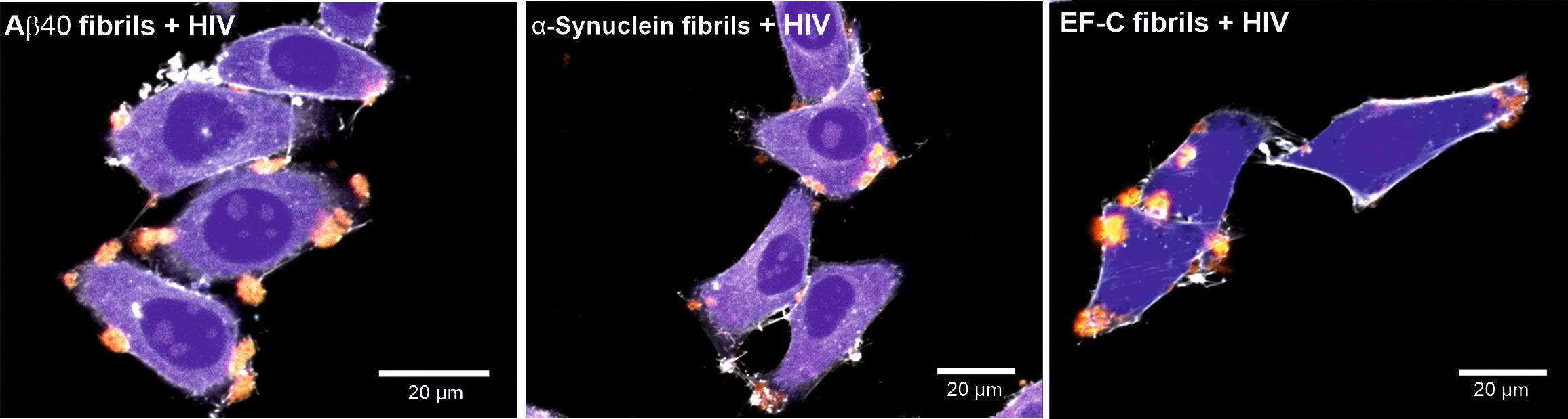 Fluorescence microscopy images showing Aβ40, α-synuclein, and EF-C fibrils that were stained with Amytracker 540 dye (red) and CFP labeled HIV (yellow) in the presence of cells stained with the cytoskeleton dye (CellTrace) (blue) and actin dye (ATTO-phalloidin) (white). 