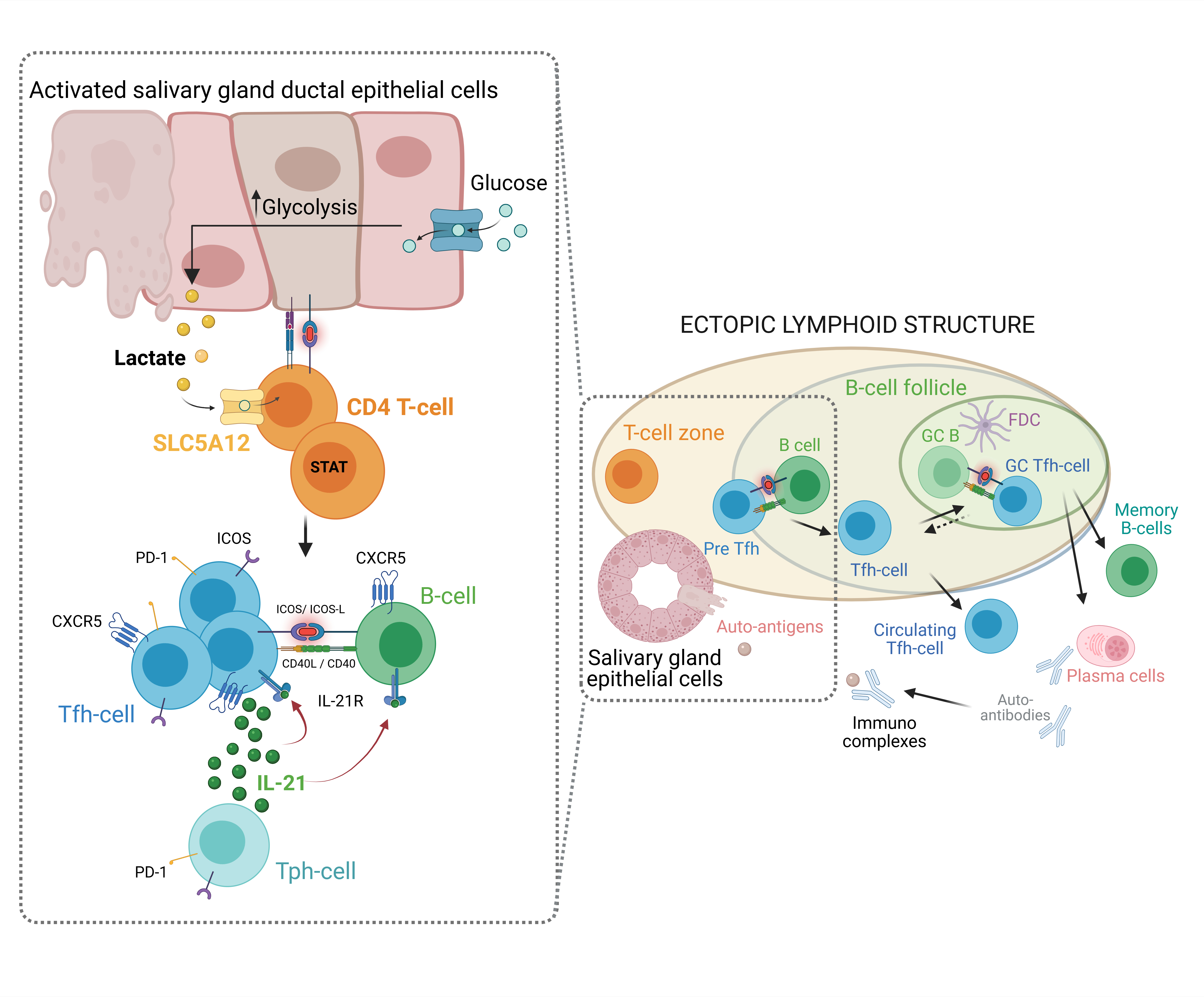 The figure illustrates the proposed impact of lactateaccumulation on T cell activation and the development of ectopic lymphoidstructures in SjD SGs. (Left panel) Activated stromal cells, such as ductalepithelial cells, and infiltrating immune cells increase glycolysis, leading tolactate production and release into the microenvironment. CD4 + T cells uptakelactate via the SLC5A12 transporter. Lactate stimulates IL21 production by Tfhand Tph cells, driving B-cell activation and differentiation. (Right panel) Withinthe ectopic lymphoid structure, B cells organize into follicles supported byfollicular dendritic cells (FDCs). Tfh cells provide help to B cells, leading to theproduction of autoantibodies and the generation of plasma cells and memoryB cells. Autoantigens from the salivary gland epithelial cells contribute to theformation of immune complexes, perpetuating the autoimmune response.