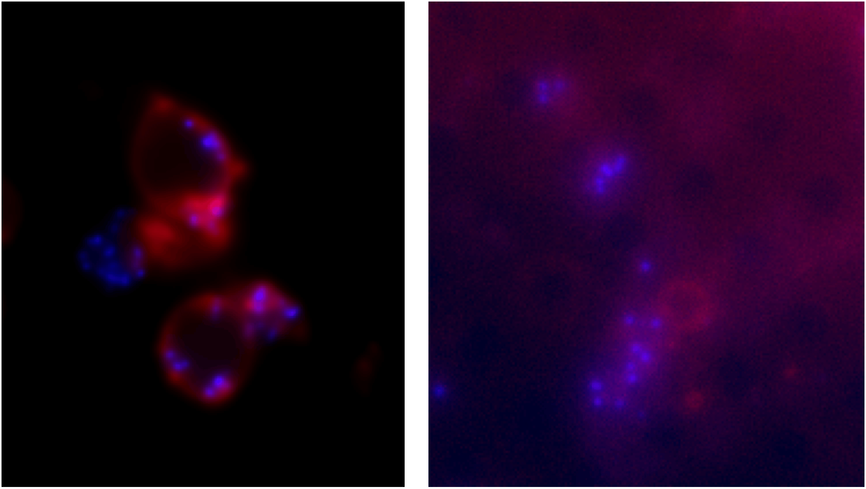 With Anna Sartori-Rupp, we had some heated debates whether the ruptured vesicles with discontinuous membranes we saw sometimes in CryoEM were a biological reality or an artefact of blotting. This little experiment settled the debate once and for all. You’re looking at an epifluorescence image (red – FM 4-64 coloration of biological membranes, blue – DAPI coloration of DNA) of Veillonella parvula ΔompM1-3 mutant deposited on a R 2/2 grid, on the left before the blotting, and on the right after it. As you can see, after the blotting the big vesicles are gone (exploded like soap bubbles hitting the ground) and fragments of the outer membrane have adhered to the mesh grid (visible as the diffuse red fluorescence with the black spots in the place of mesh grid holes)