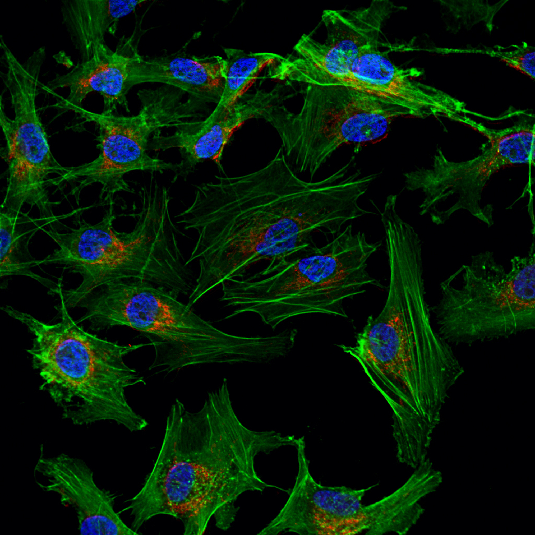 Mesenchymal stem cells labeled with fluorescent molecules