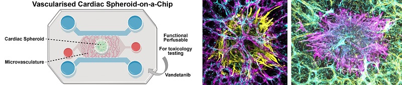 Composite image showing a representation of the microvascularised cardiac spheroid on a chip and two confocal images of vascularised spheroids.