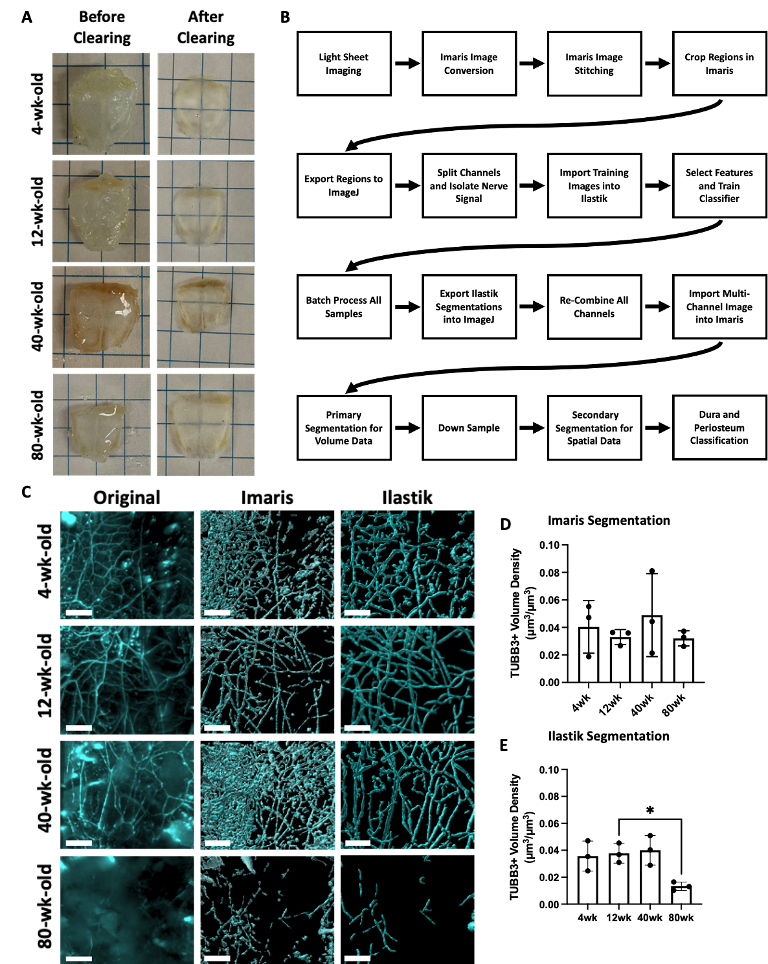 A) 4wk, 12wk, 40wk, and 80wk calvaria before and after tissue clearing with 2’2-thiodiethanol. B) Workflow of quantitative nerve analysis beginning with lightsheet imaging, followed image processing with Imaris®, ImageJ®, and Ilastik®. C) Comparison of segmentation of nerves using Imaris® and Ilastik® relative to the original fluorescent images acquired with QLSM. Scale bar is 250 μm. D) Imaris®-derived volume fraction for TUBB3+ nerves in the frontal bone region. E) Ilastik®-derived volume fraction for TUBB3+ nerves in the frontal bone region. Data are mean ± SD. Statistics were performed with a two-way ANOVA with post-hoc Tukey HSD test. *p<0.05 where designated. 