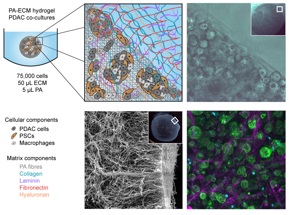 Pancreatic cancer and stromal cells thrive in matrix-rich self-assembled hydrogels.