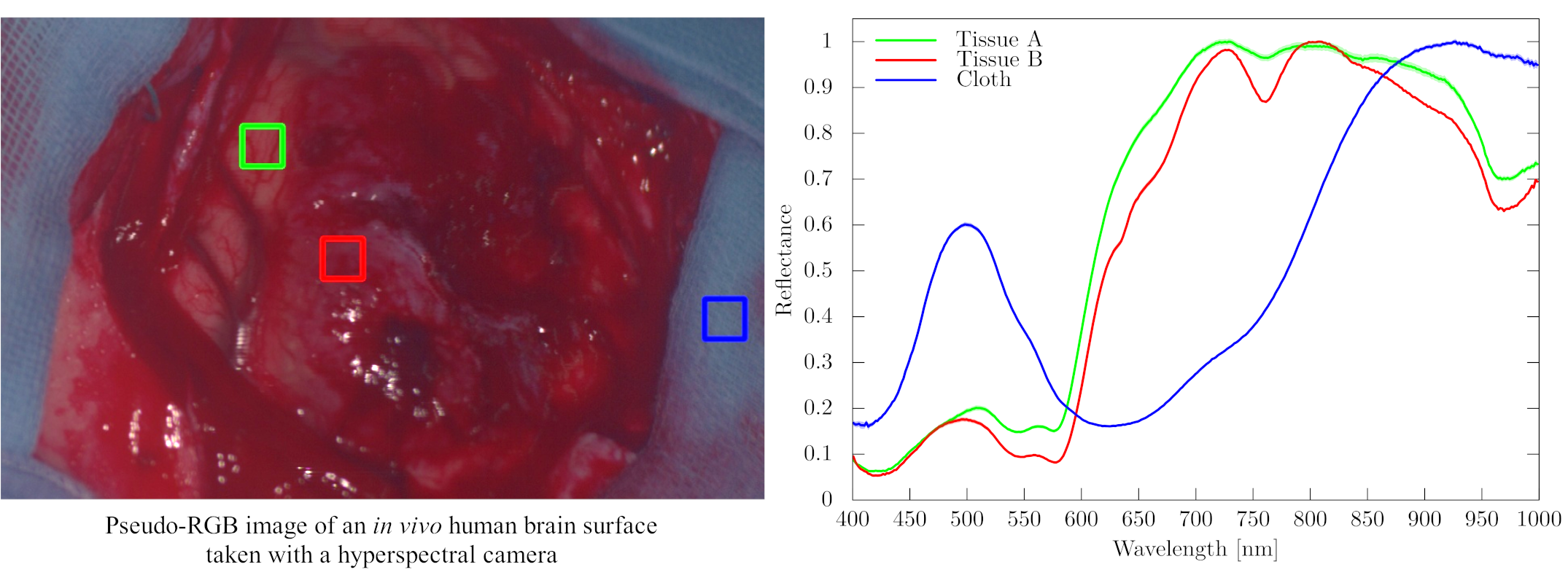 Spectral signatures of an in vivo human brain surface captured with a hyperspectral camera used for the SLIMBRAIN database