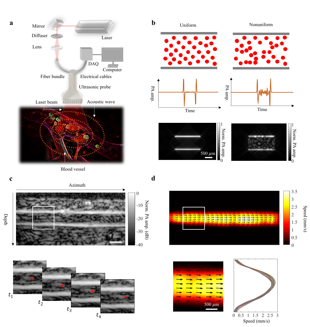 a, Schematic of the imaging system. Light from a laser is delivered to the blood vessel region via a fiber bundle. Photoacoustic waves are generated and then detected by the ultrasonic probe. Photoacoustic signals are streamed to the computer through the data acquisition (DAQ) module. b, Effect of blood heterogeneity on the visibility of the signals arising from the lumen region of the blood vessel. For uniform blood, the simulated photoacoustic signals from the lumen region are suppressed relative to the signals at the boundaries, resulting in little visibility in the lumen region of the image, whereas in nonuniform blood, the simulated photoacoustic signals from the lumen region show an increased amplitude, resulting in heightened visibility in the lumen region relative to the uniform case. c, Structural images of a blood vessel are reconstructed in real-time. Magnified view of the region in the white box in c (top row) shows that the image features in the lumen region (beyond 1 mm depth) can be tracked in successive images at time points t_1 to t_4. d, After tracking all of the features in the field of view, a blood flow speed map is reconstructed. Quantitative representation of the flow vector fields is overlayed on the speed map. Magnified view of the region in the white box in d (top row) shows that the flow has a laminar pattern.