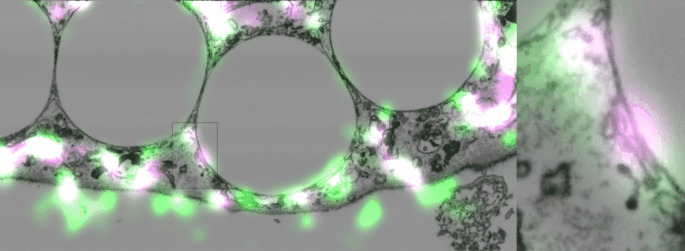 The movie shows data from Figure 1 of the paper. It scrolls through a 3D stack of images taken with the focused-ion-beam electron microscope in black and white, overlaid with the corresponding fluorescent images taken with a confocal microscope, in green and magenta.  The large white object is a phagosome containing an ingested polystyrene bead. All membranes appear as black lines, and the contact site is the area where flattened membranes are found right up against the phagosome membrane surrounding the bead. STIM1 is shown in green and Sec22b in magenta.
