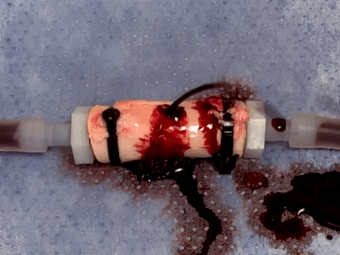 Bleeding ex vivo porcine aorta