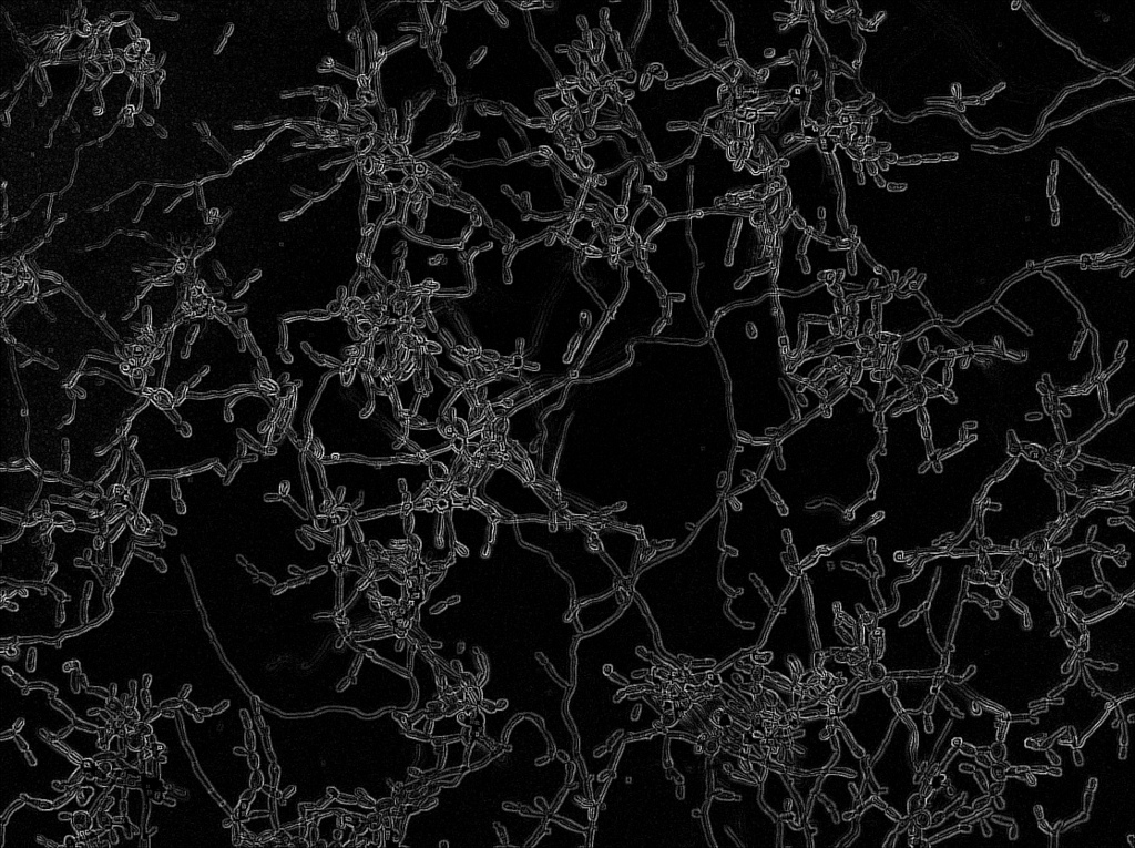 From population heterogeneity to clinical persistence of fungal infections