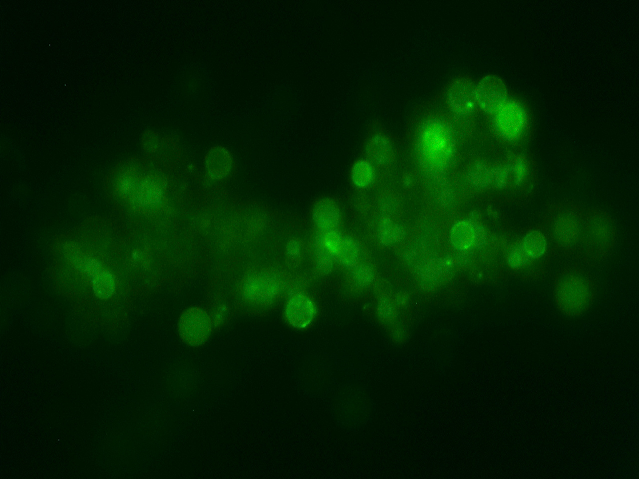 Stress-induced cell wall-deficiency