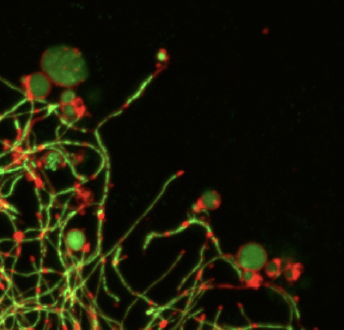 Bacterial growth under pressure: the surprising role of membrane microdomains