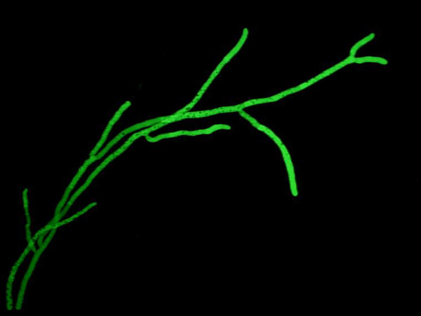 Deep eukaryotic roots for the underground fungal network.