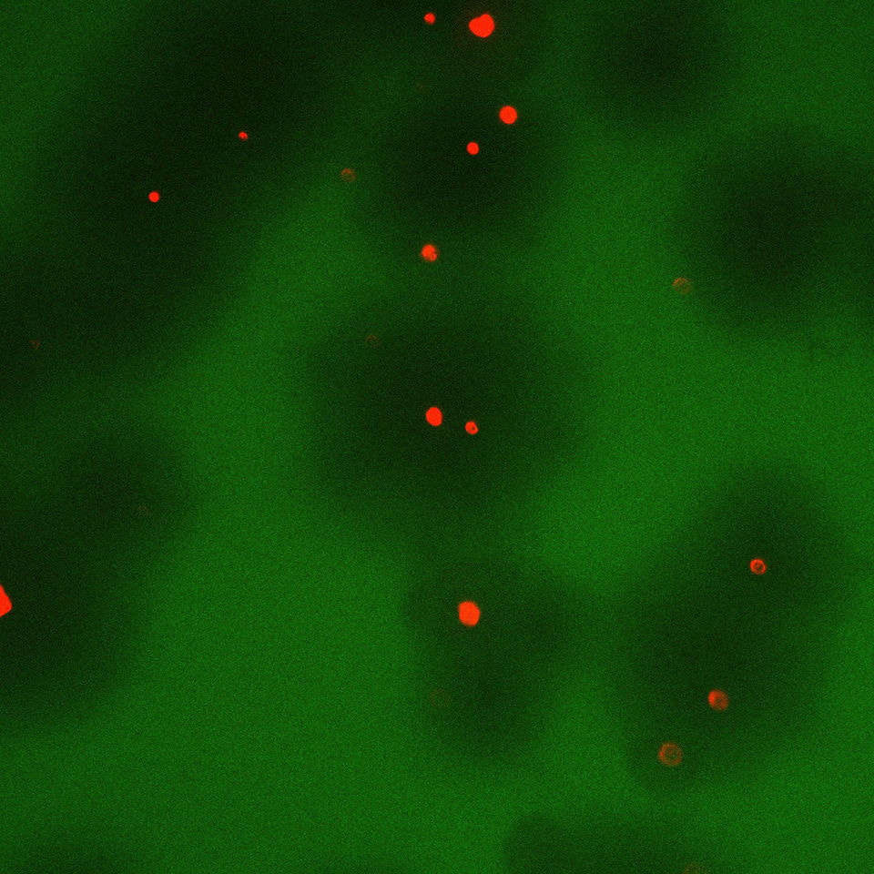 Using bacteriophage virus to tackle bacterial lung infections