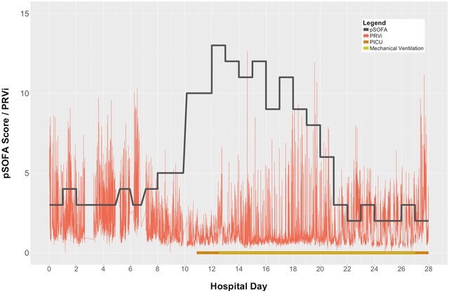Photoplethysmography sensor technology as a window to the autonomic nervous system response in high-risk patients 