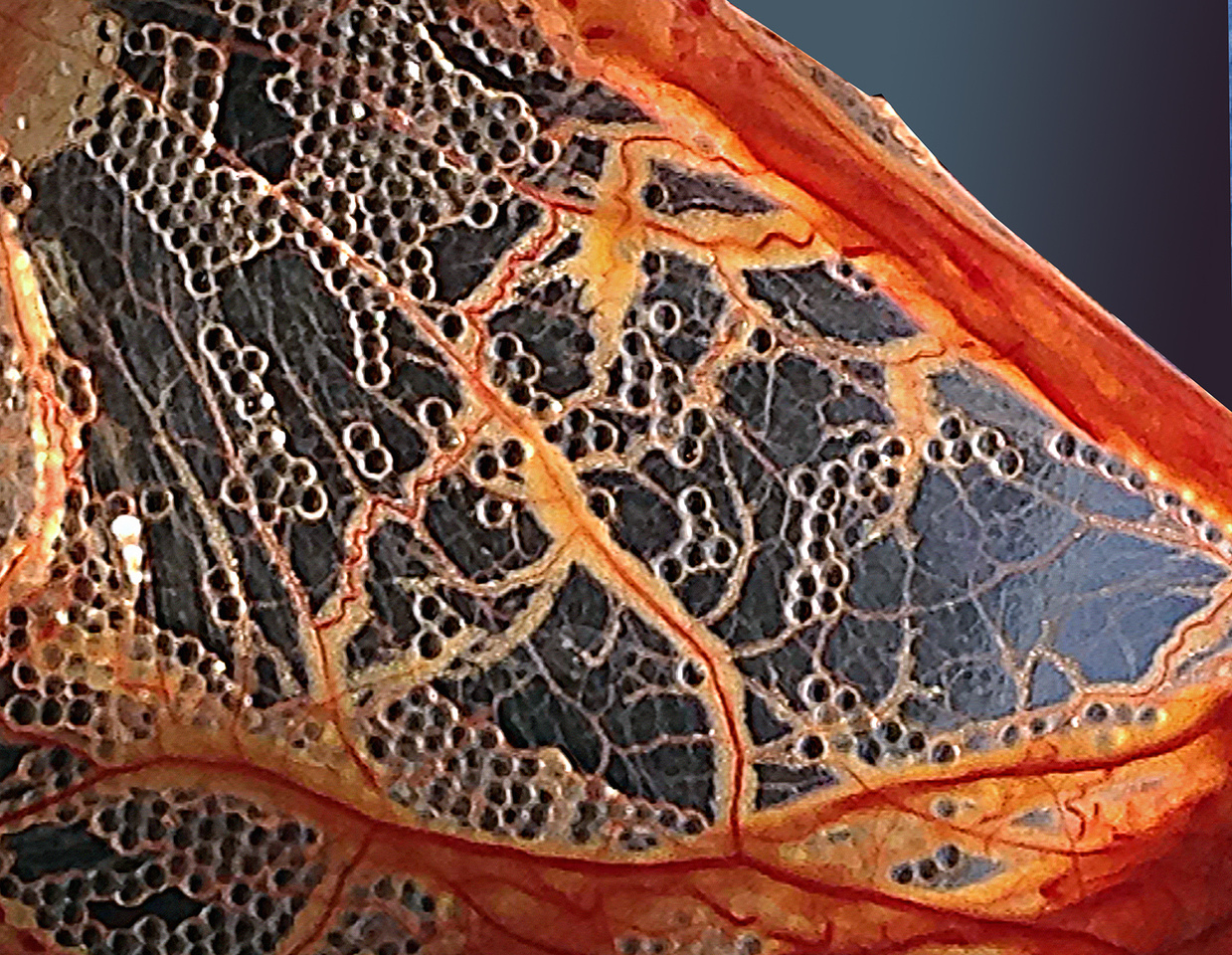 Anti-fibrotic alginate protects allogeneic islets in macaques