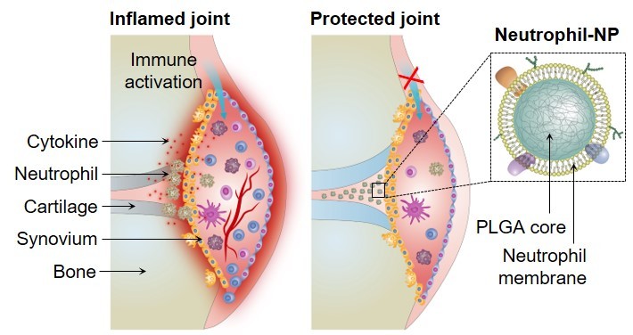 Neutrophil-mimicking nanoparticles intercept inflammation signals and suppress joint damages in experimental arthritis
