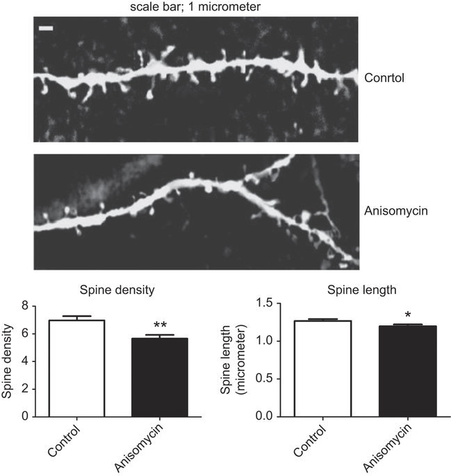 Editorial Summary: The differential role of cortical protein synthesis in taste memory formation and persistence
