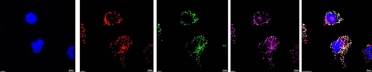 Pneumococcus hijacks a host receptor to evade the immune response 