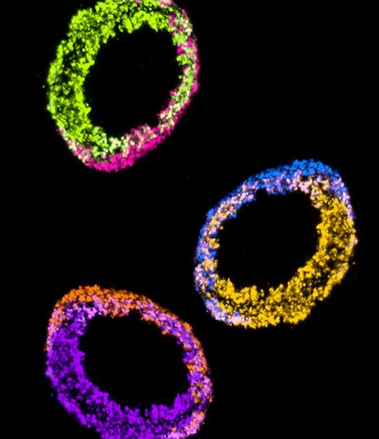 Flies are key to human learning