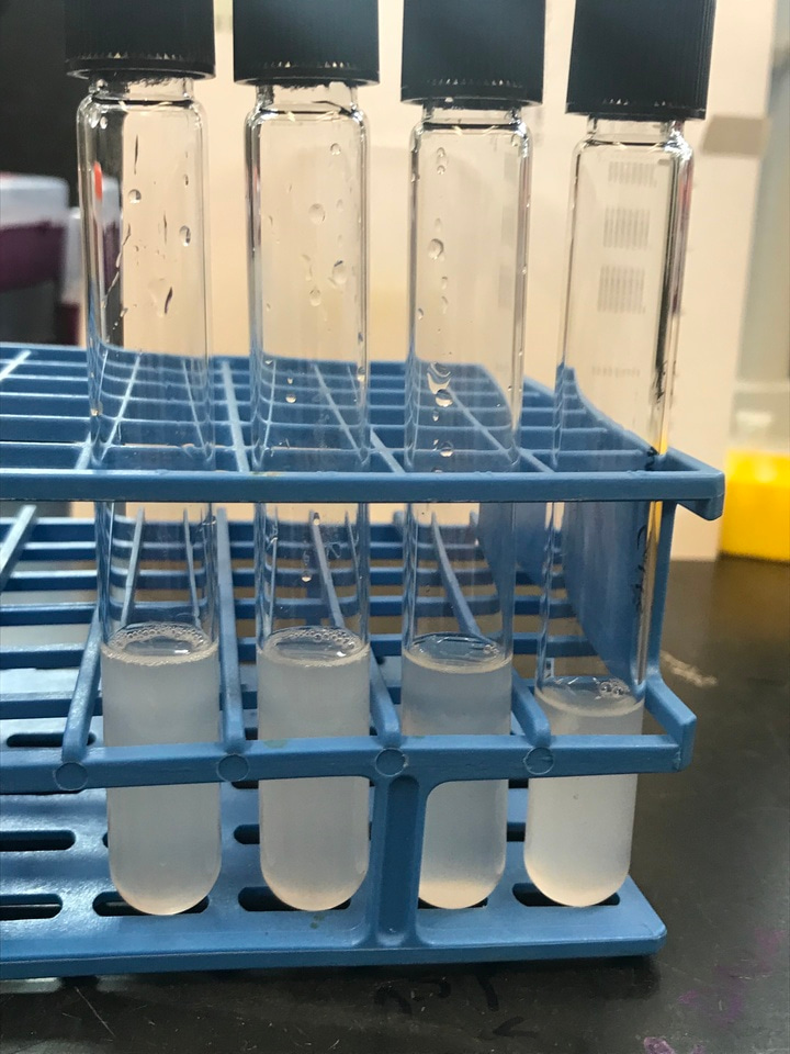 Cutting through the fat: discovering a lipid metabolizing enzyme from the gut microbiota