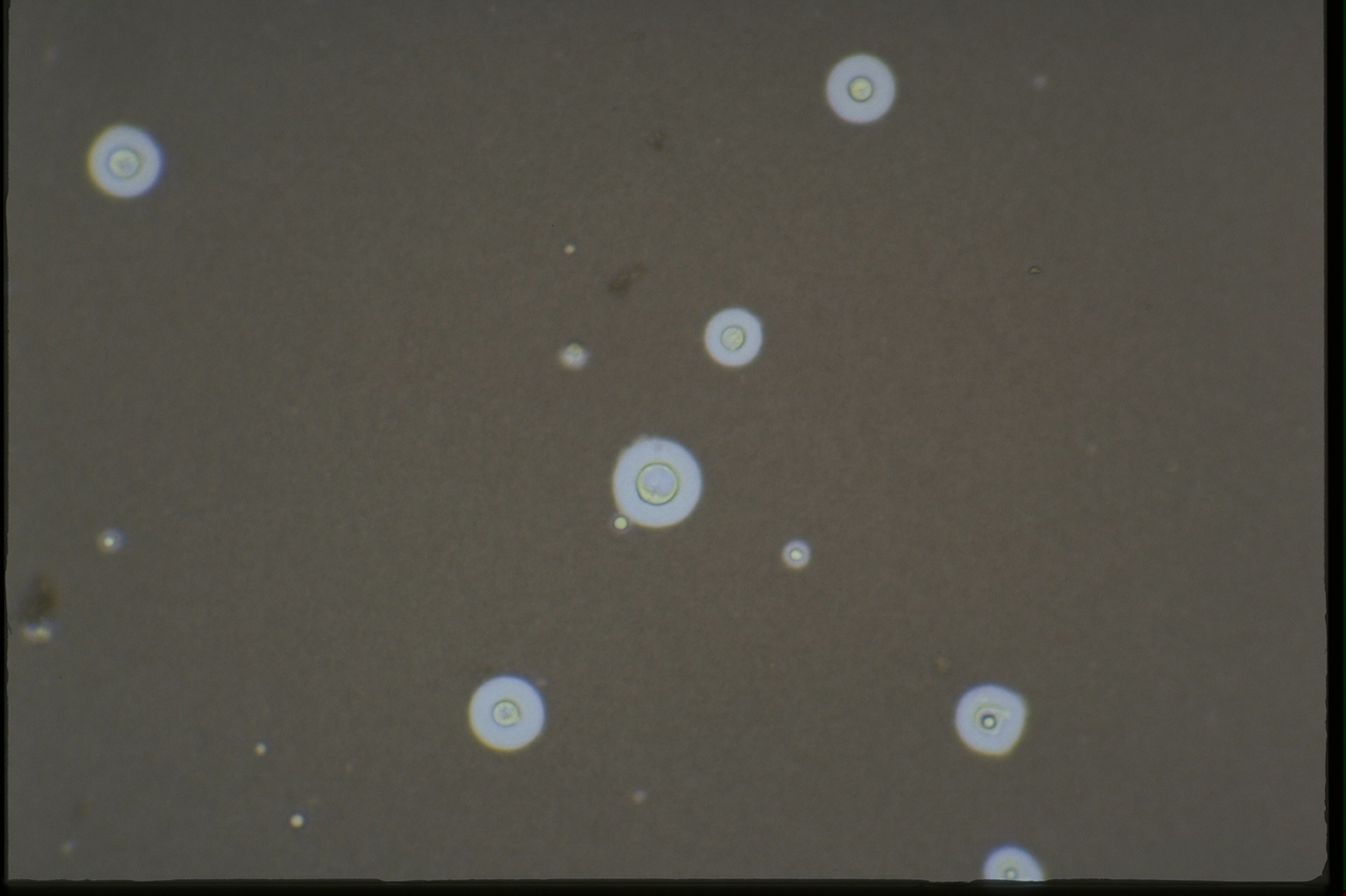 Diagnosing fungal infections: The not so FUN part of FUNgal pathogenesis