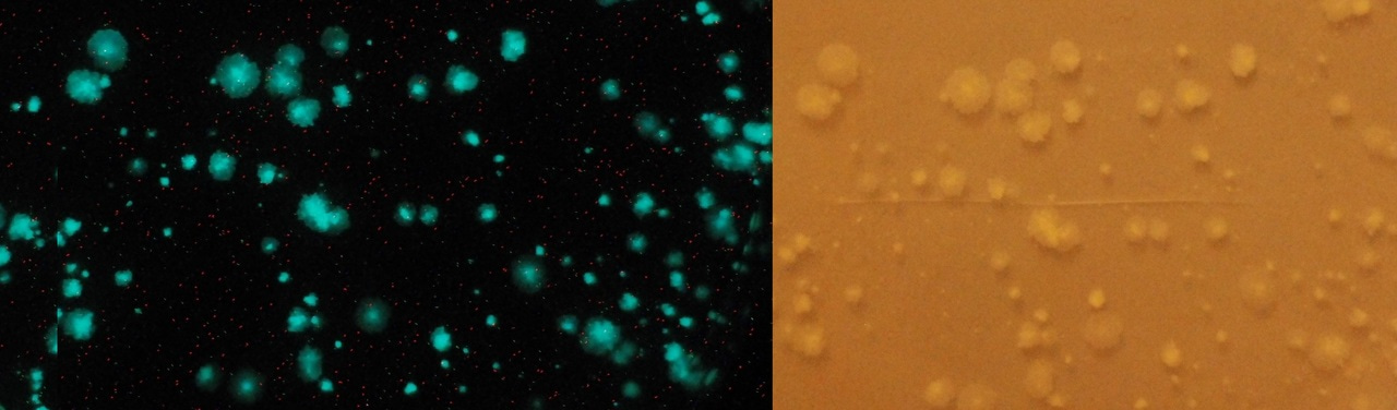 The Achilles' Heel Targeted by TB47 Is Protected in Select Mycobacteria. 