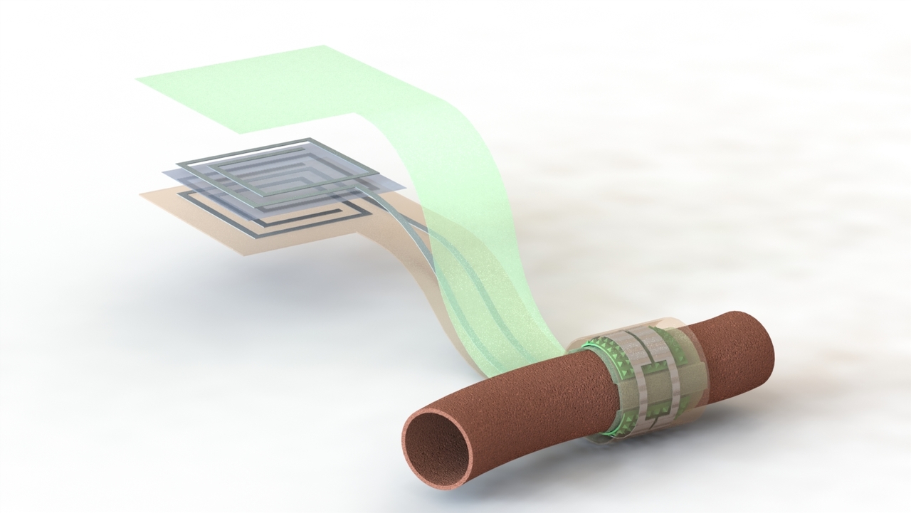 Biodegradable and wireless blood flow sensor