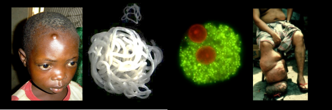 Potential novel fast acting drug candidates identified to cure filarial diseases 