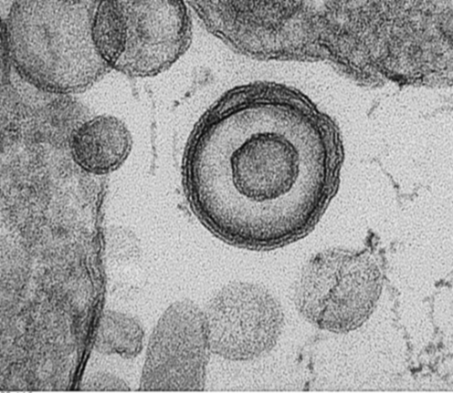 Culprit within a Culprit: Leishmania exosomes as an ancient viral disguise technique