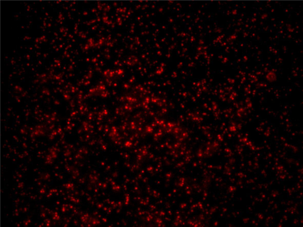 Insights into the Regulation of Gene Transfer Agent Production 