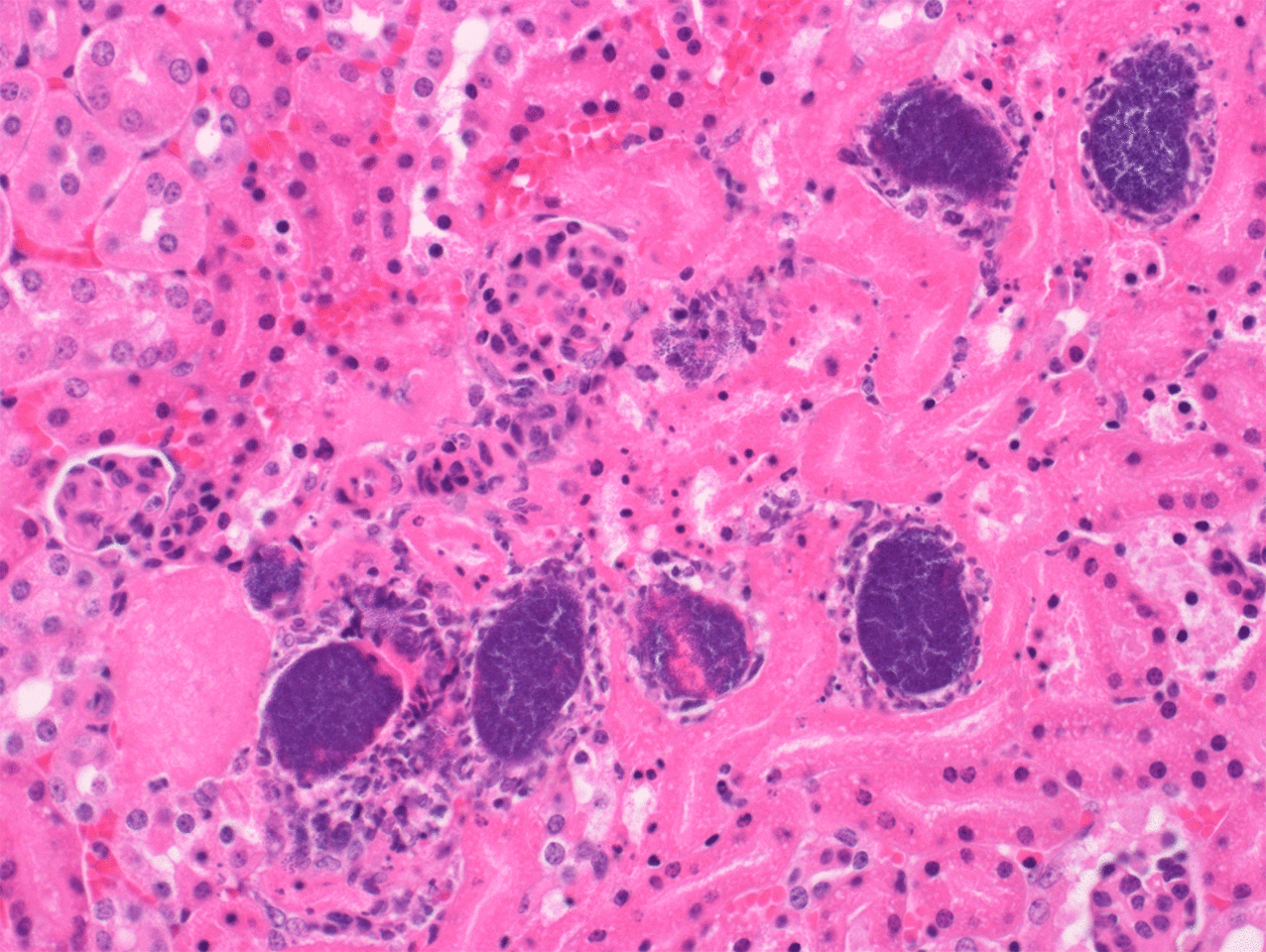 A new regulator of Staphylococcus aureus virulence
