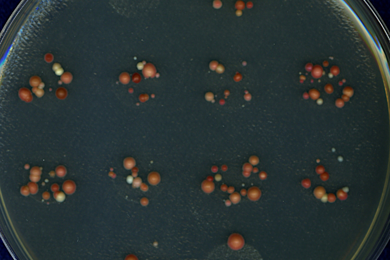 A ten-year pursuit of bypassable gene essentiality