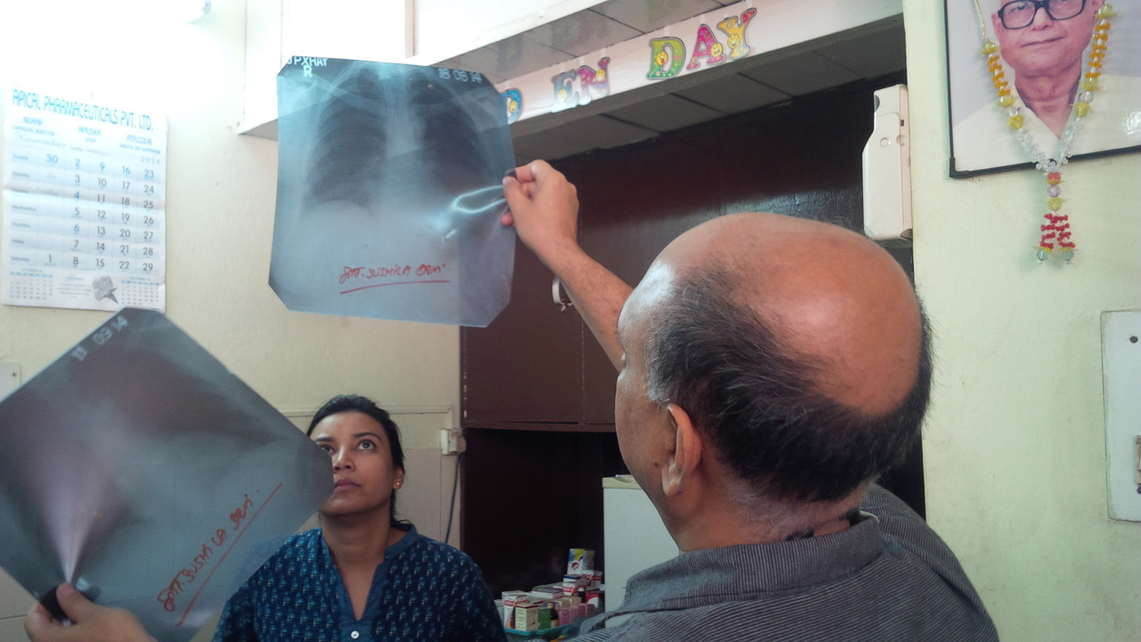 India continues to bear the brunt of the TB epidemic